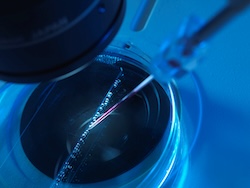 sickle cell research